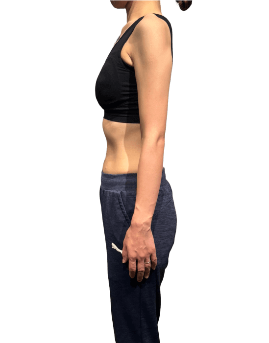 お客様の声1アフター