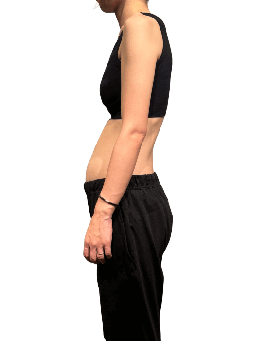 お客様の声1ビフォー