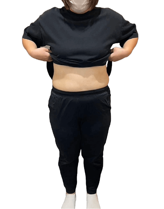 お客様の声3アフター