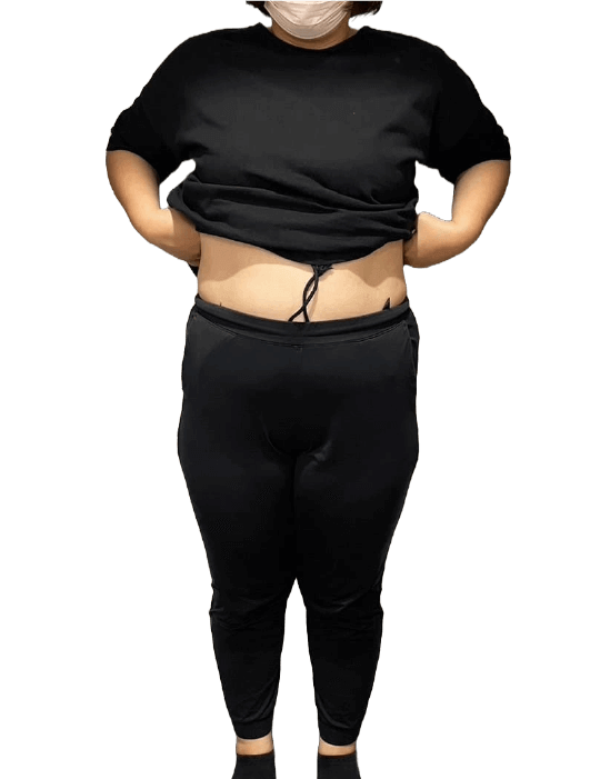 お客様の声3ビフォー